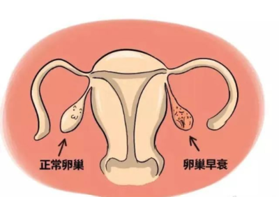 没有避孕一直怀不上,究竟怎么了?引起男女不孕症的主要原因有哪些?