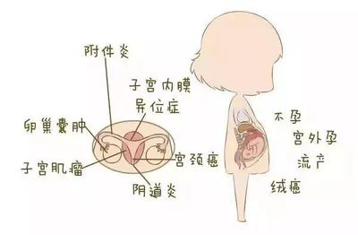 一张“女性妇科疾病”地图,揭示女性不同阶段的生理特点!