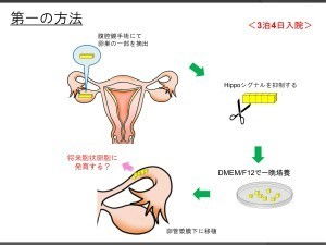 jmt日本医疗 不孕症的治疗方法卵巢功能减退的新恢复方法 干细胞