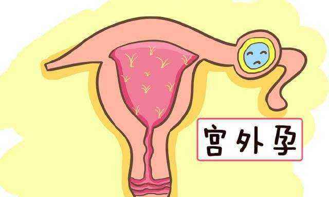 兰州天伦不孕症医院简介 异位妊娠有哪些类型