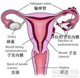 子宫肌瘤的危害都有哪些方面