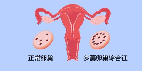 试管婴儿