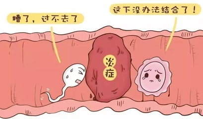 孕育之殇--输卵管性不孕症