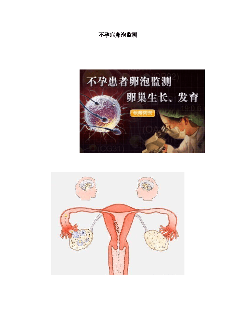 不孕症卵泡监测曹雁论述.doc