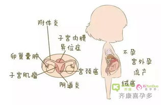 有哪些因素导致现在不孕不育率居高不下 不孕不育的原因有哪些