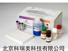 抗卵巢抗体Aoab ELISA试剂盒 不孕不育试剂盒_供应产品_北京科瑞美科技