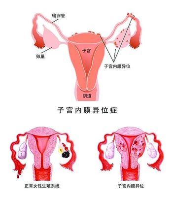 没有避孕一直怀不上,究竟怎么了?引起男女不孕症的主要原因有哪些?