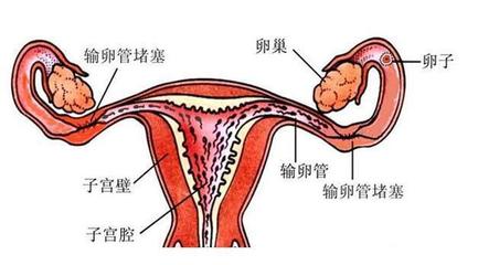 这5类女性不孕几率大,看看其中有你吗?