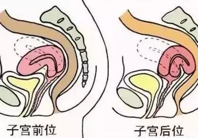 女性不孕症的原因有哪些 如何预防女性不孕