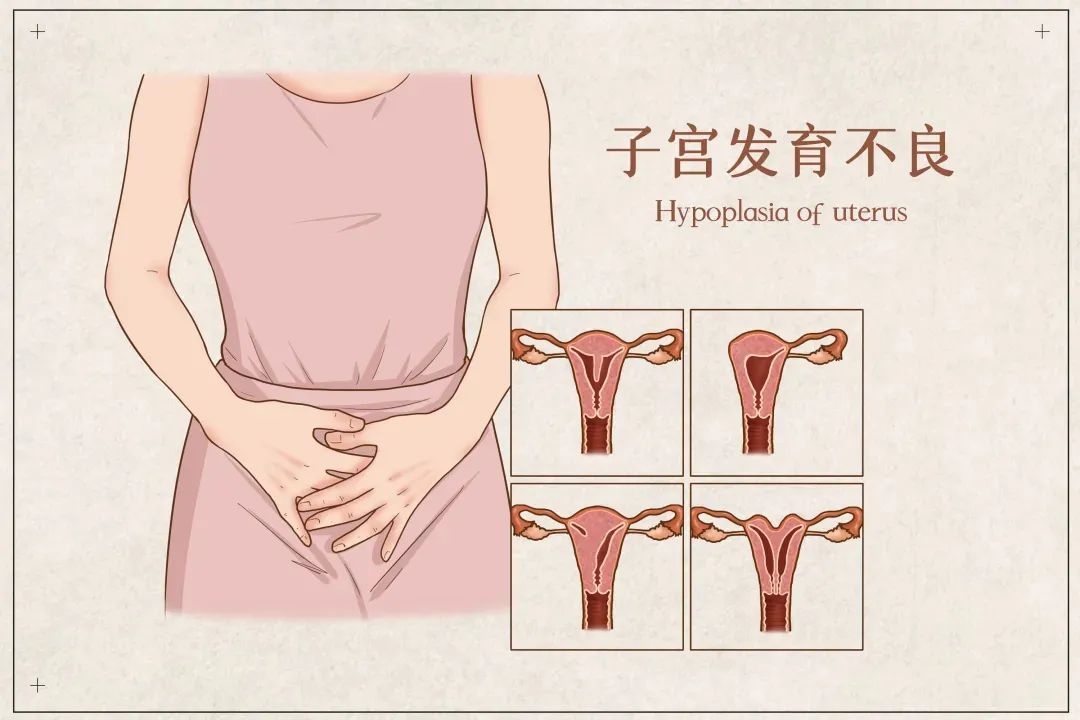 双子宫孕妇紧急剖宫产!生殖道畸形对生育和性生活有哪些影响|宫颈_网