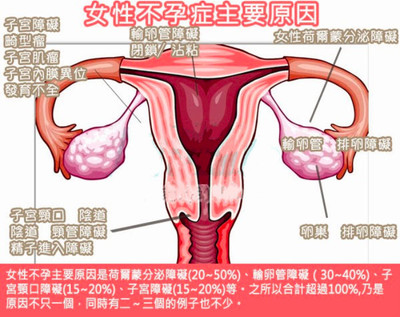 什么叫不孕症?