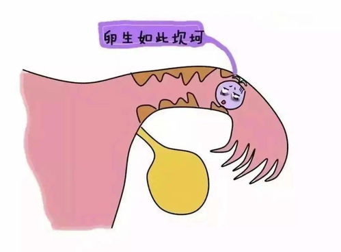 输卵管不孕原因大揭秘 想要好孕应该这样做