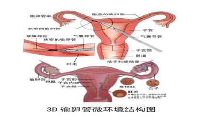 不孕症 常见症状与疾病概述